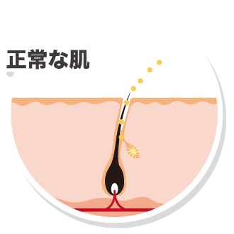 正常な肌